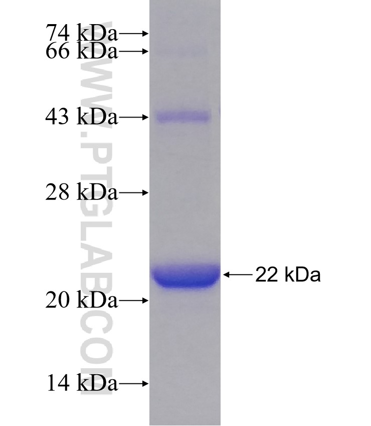 SETD8 fusion protein Ag30581 SDS-PAGE