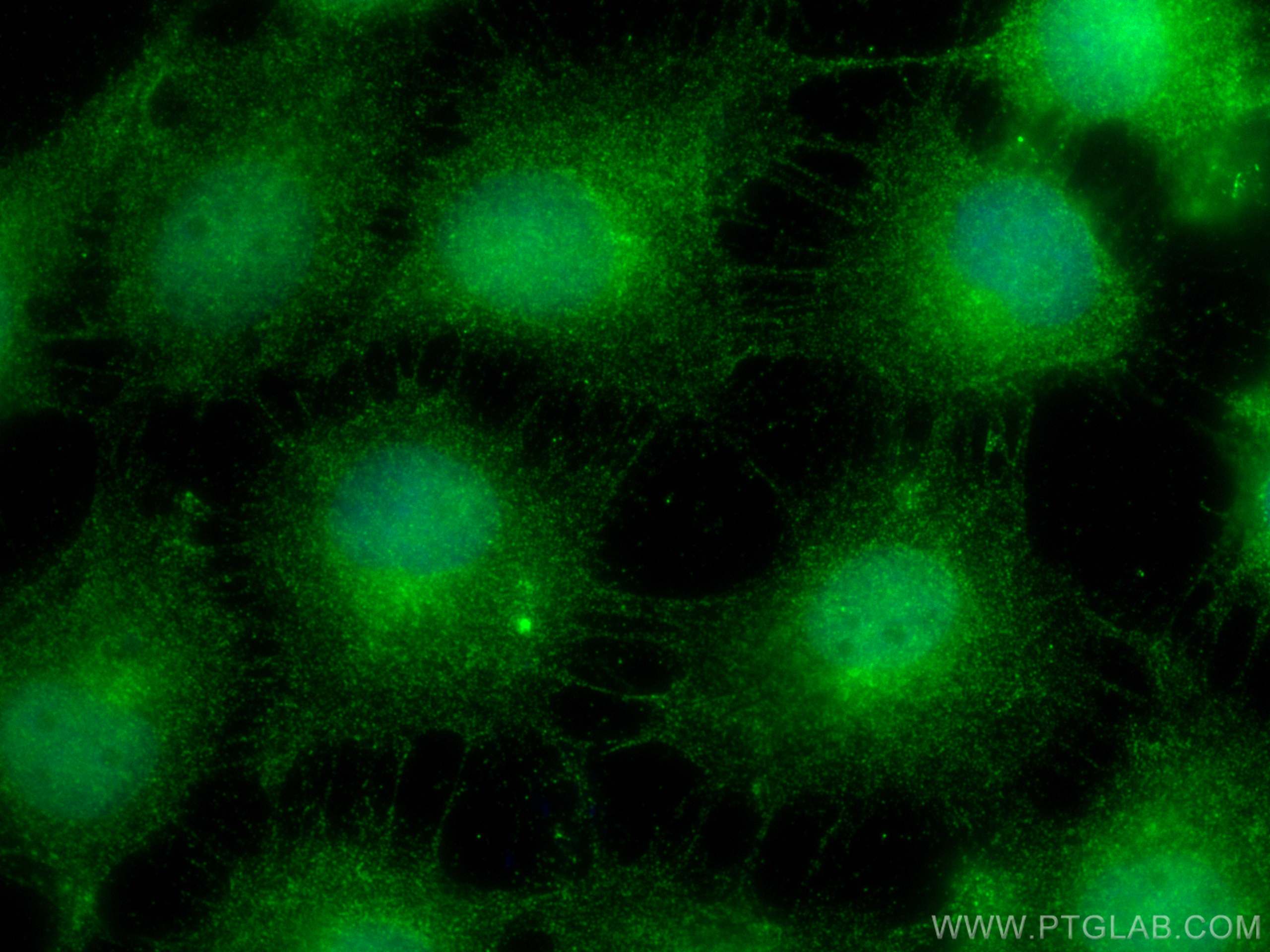 Immunofluorescence (IF) / fluorescent staining of A431 cells using SETDB1 Monoclonal antibody (66293-1-Ig)