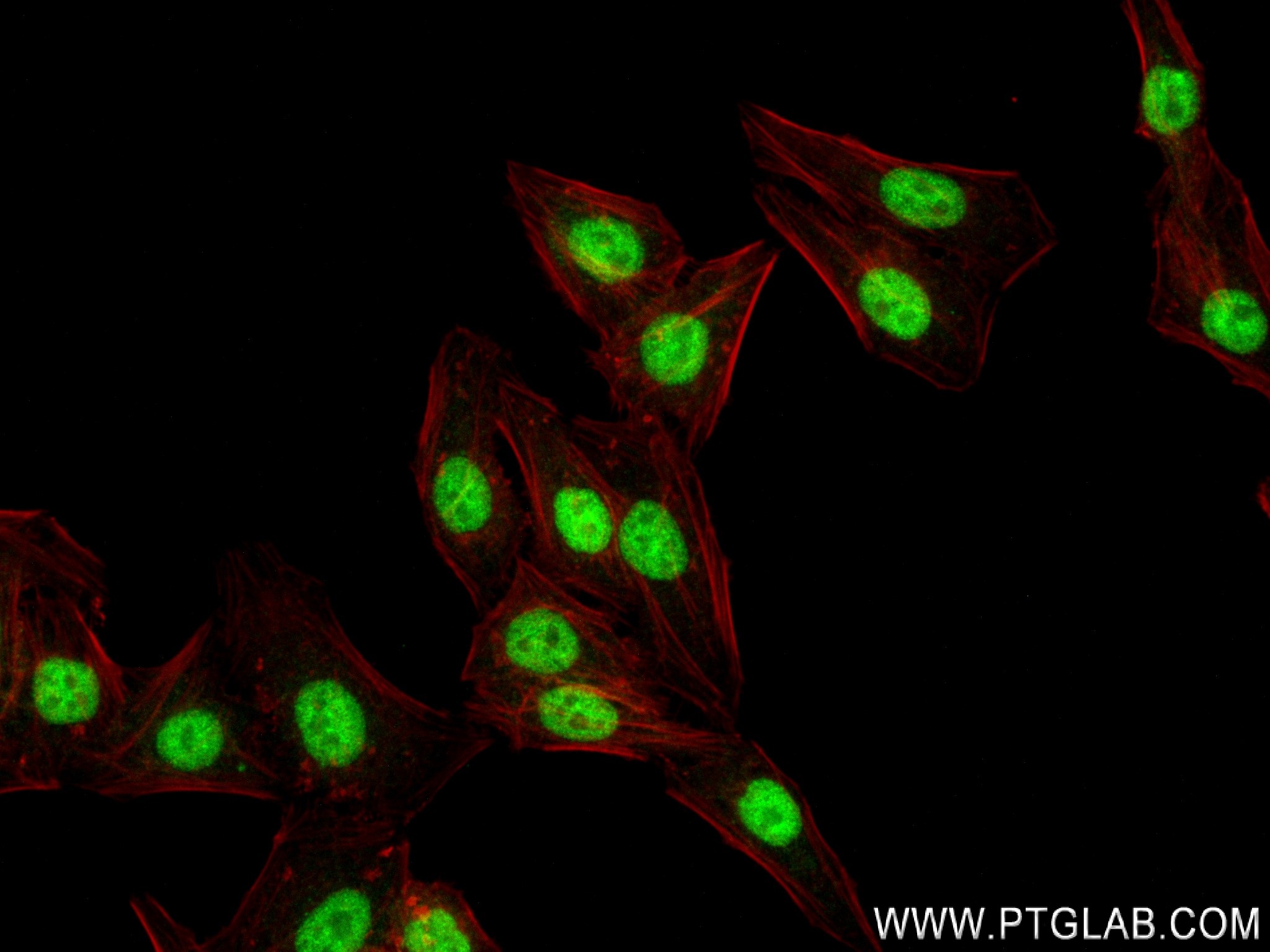 Immunofluorescence (IF) / fluorescent staining of HepG2 cells using SETDB1 Recombinant antibody (83772-6-RR)