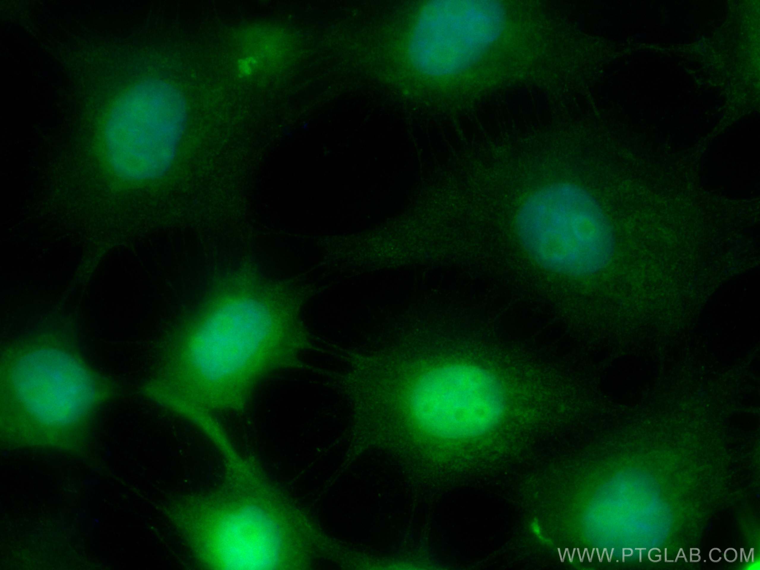 Immunofluorescence (IF) / fluorescent staining of A431 cells using CoraLite® Plus 488-conjugated SETDB1 Monoclonal an (CL488-66293)