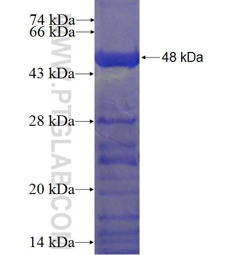 SETMAR fusion protein Ag23011 SDS-PAGE