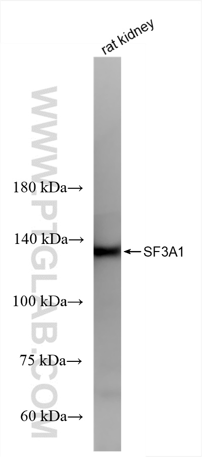 Western Blot (WB) analysis of rat kidney tissue using SF3A1 Recombinant antibody (86170-2-RR)