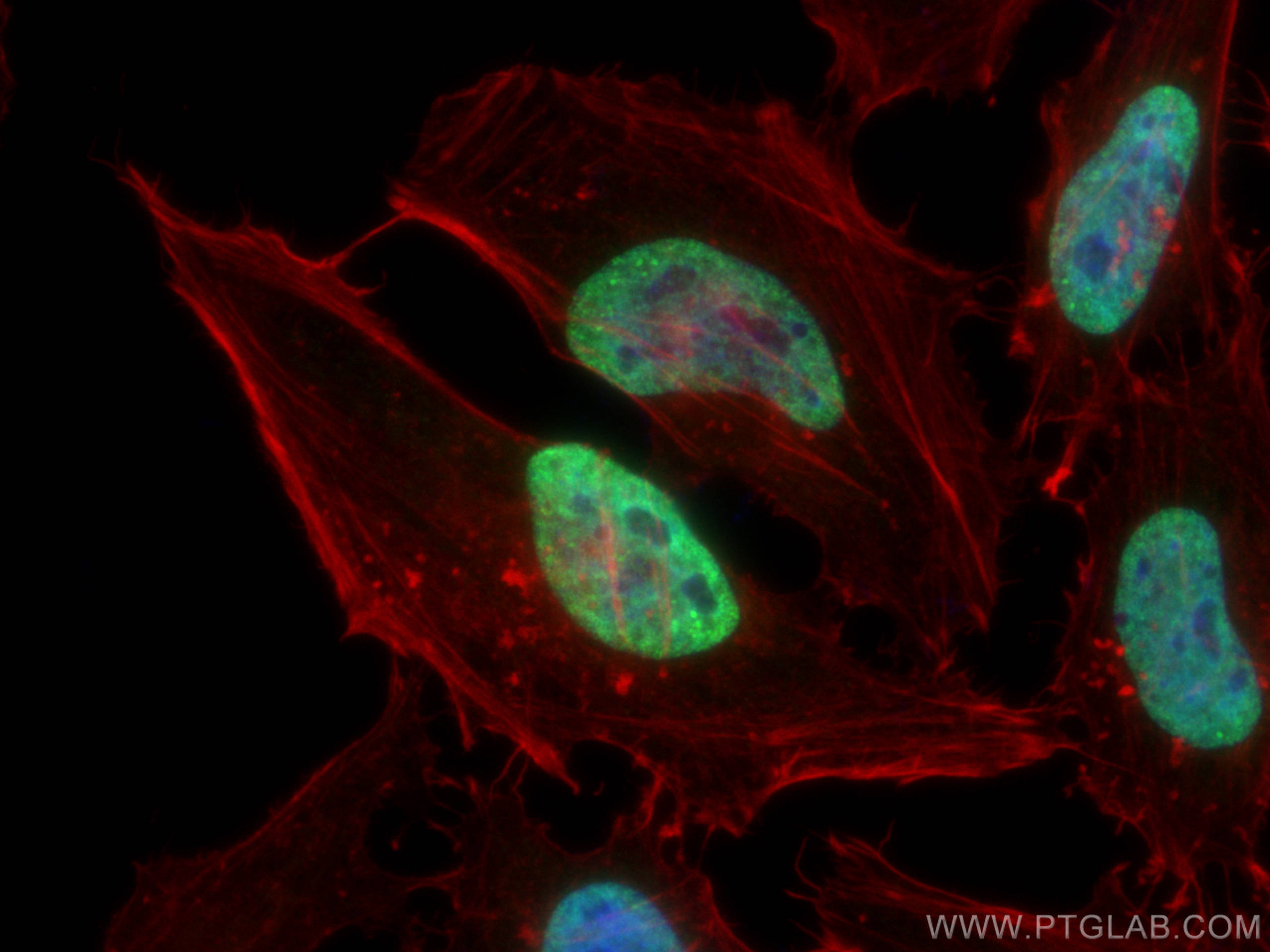 Immunofluorescence (IF) / fluorescent staining of HeLa cells using SFPQ Polyclonal antibody (15585-1-AP)