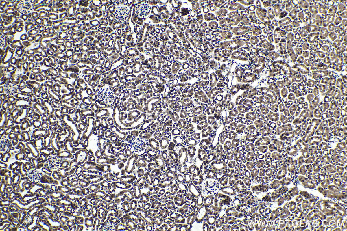 Immunohistochemistry (IHC) staining of mouse kidney tissue using SFRS9 Polyclonal antibody (17926-1-AP)