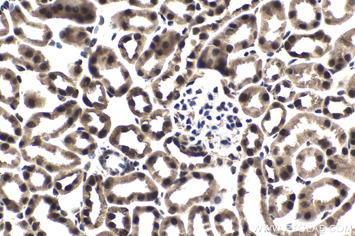 Immunohistochemistry (IHC) staining of mouse kidney tissue using SFRS9 Polyclonal antibody (17926-1-AP)