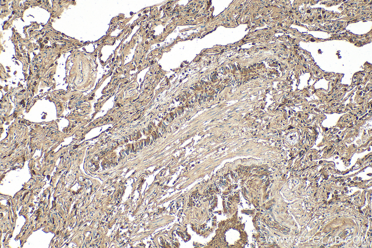 Immunohistochemistry (IHC) staining of human lung tissue using SFTPB Polyclonal antibody (13664-1-AP)