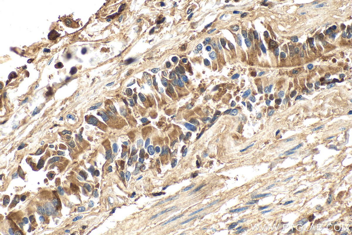 Immunohistochemistry (IHC) staining of human lung tissue using SFTPB Polyclonal antibody (13664-1-AP)