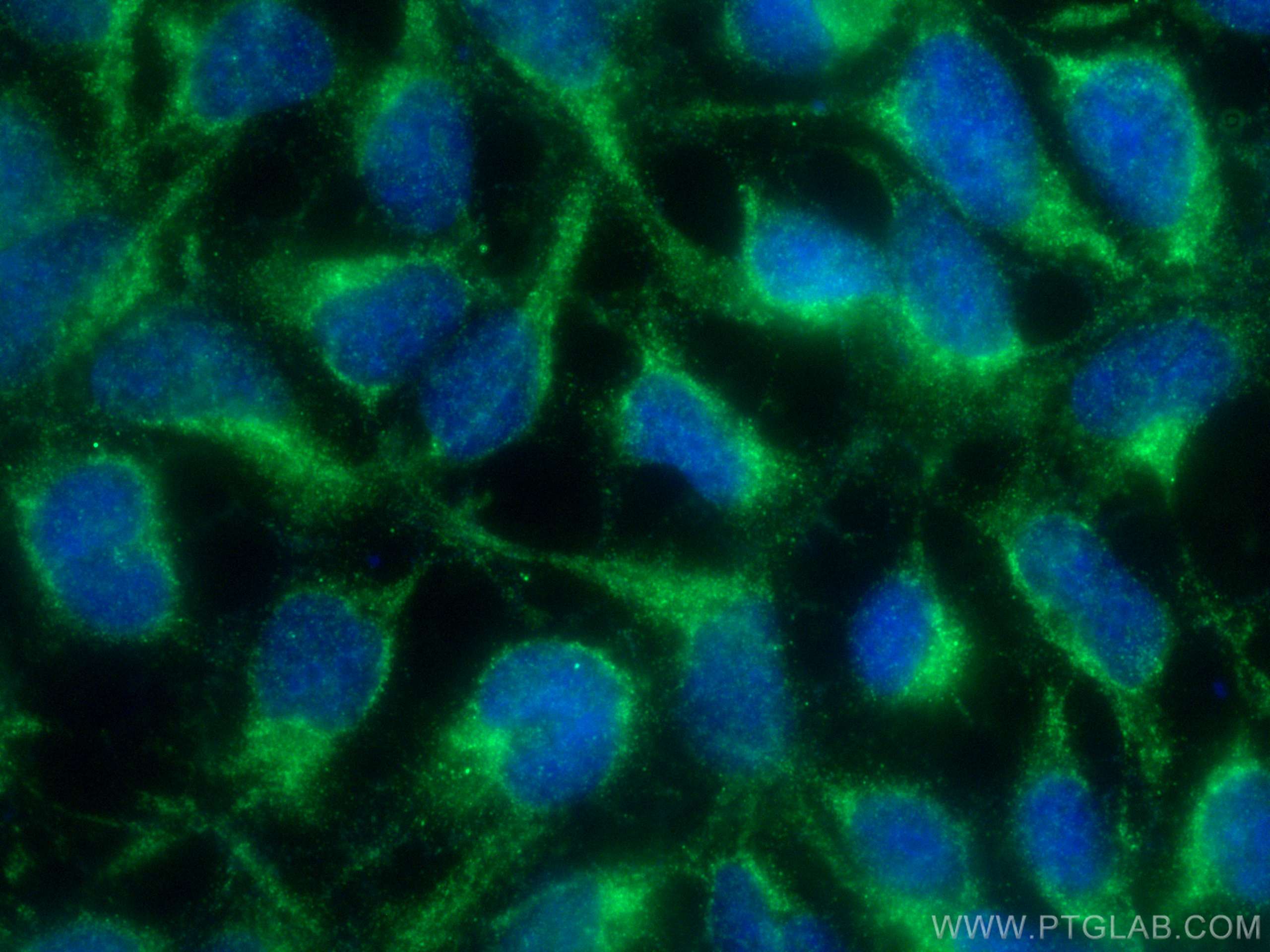 Immunofluorescence (IF) / fluorescent staining of HEK-293 cells using SGK1 Polyclonal antibody (23394-1-AP)