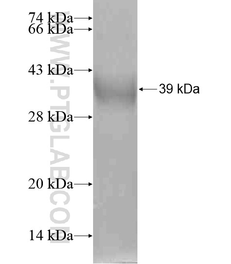 SGK493 fusion protein Ag20720 SDS-PAGE