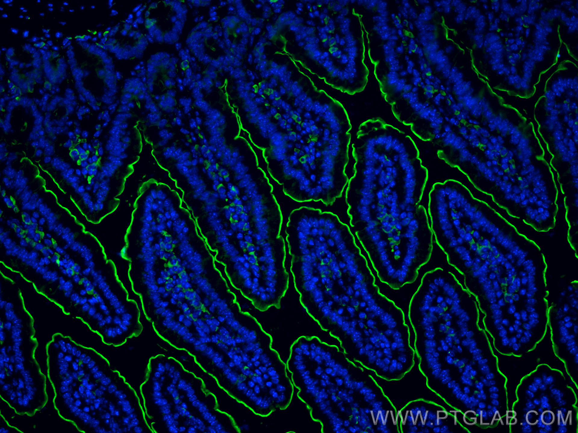 Immunofluorescence (IF) / fluorescent staining of mouse small intestine tissue using SGLT1 Polyclonal antibody (30861-1-AP)