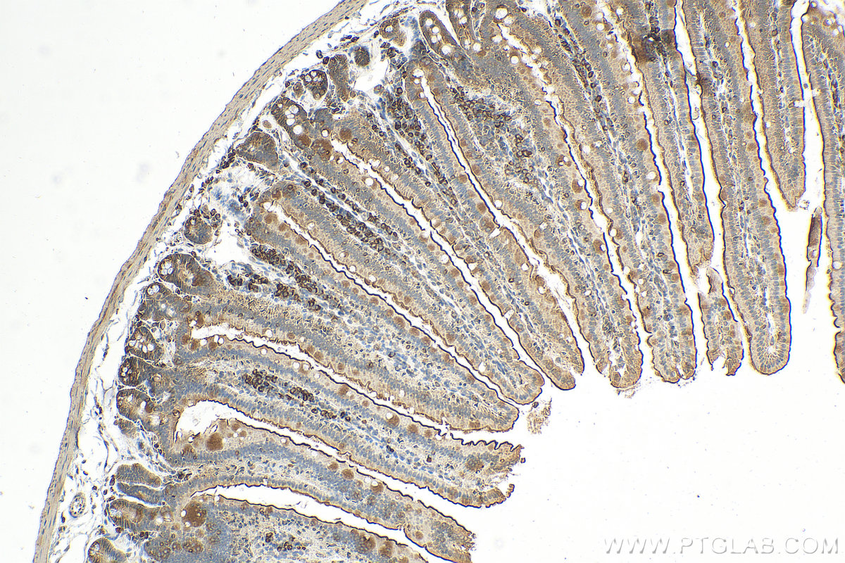 Immunohistochemistry (IHC) staining of mouse small intestine tissue using SGLT1 Polyclonal antibody (30861-1-AP)