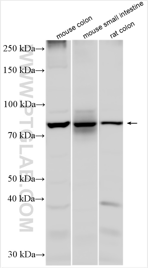 Western Blot (WB) analysis of various lysates using SGLT1 Polyclonal antibody (30861-1-AP)