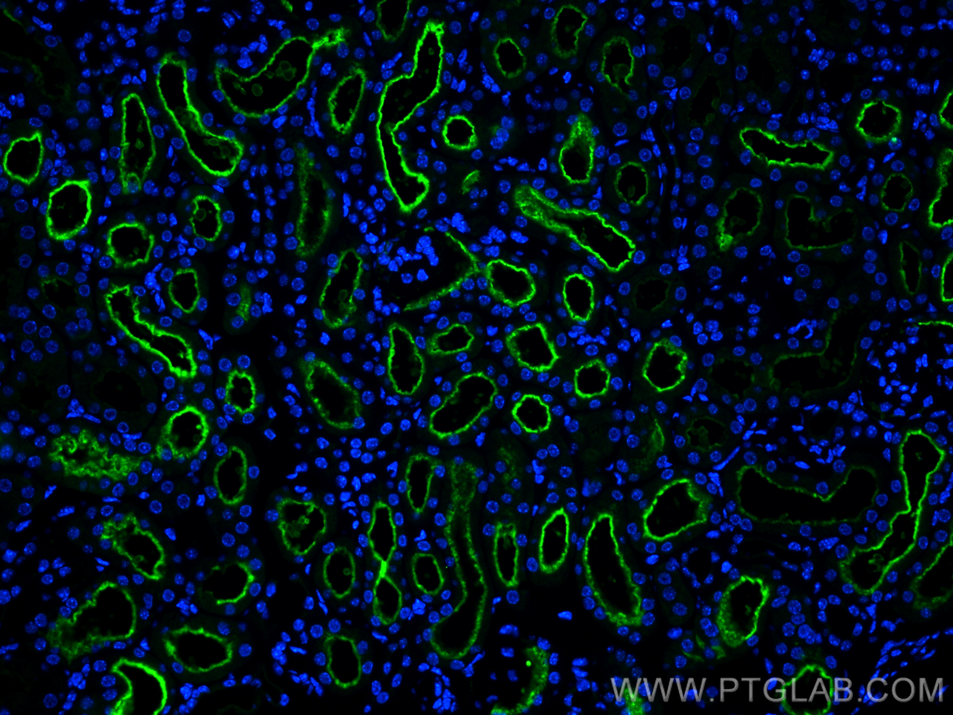 Immunofluorescence (IF) / fluorescent staining of mouse kidney tissue using SGLT2 Polyclonal antibody (24654-1-AP)