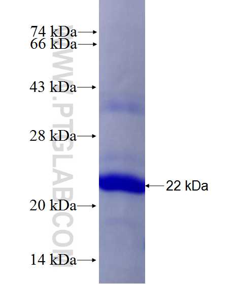 SGSH fusion protein Ag27769 SDS-PAGE