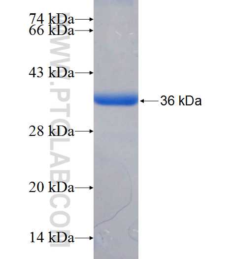 SGSM3 fusion protein Ag25959 SDS-PAGE