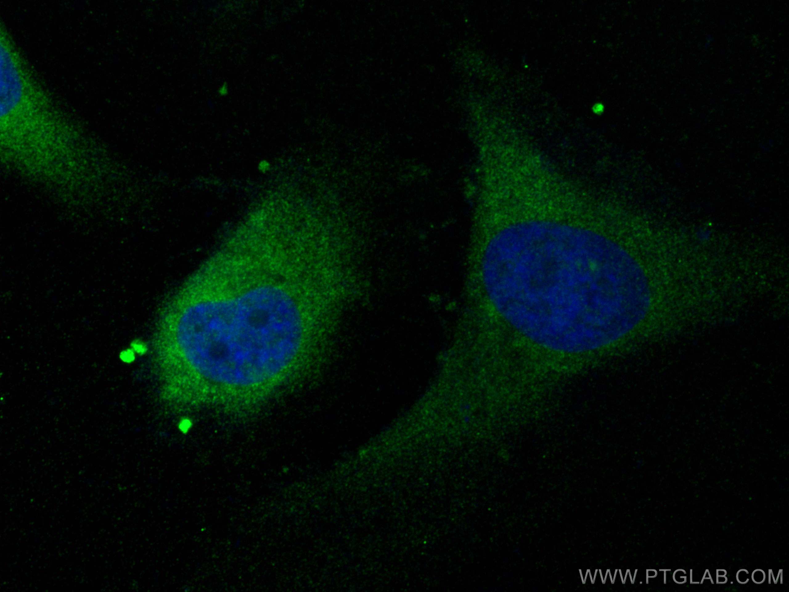 Immunofluorescence (IF) / fluorescent staining of HeLa cells using SGTA Polyclonal antibody (11019-2-AP)