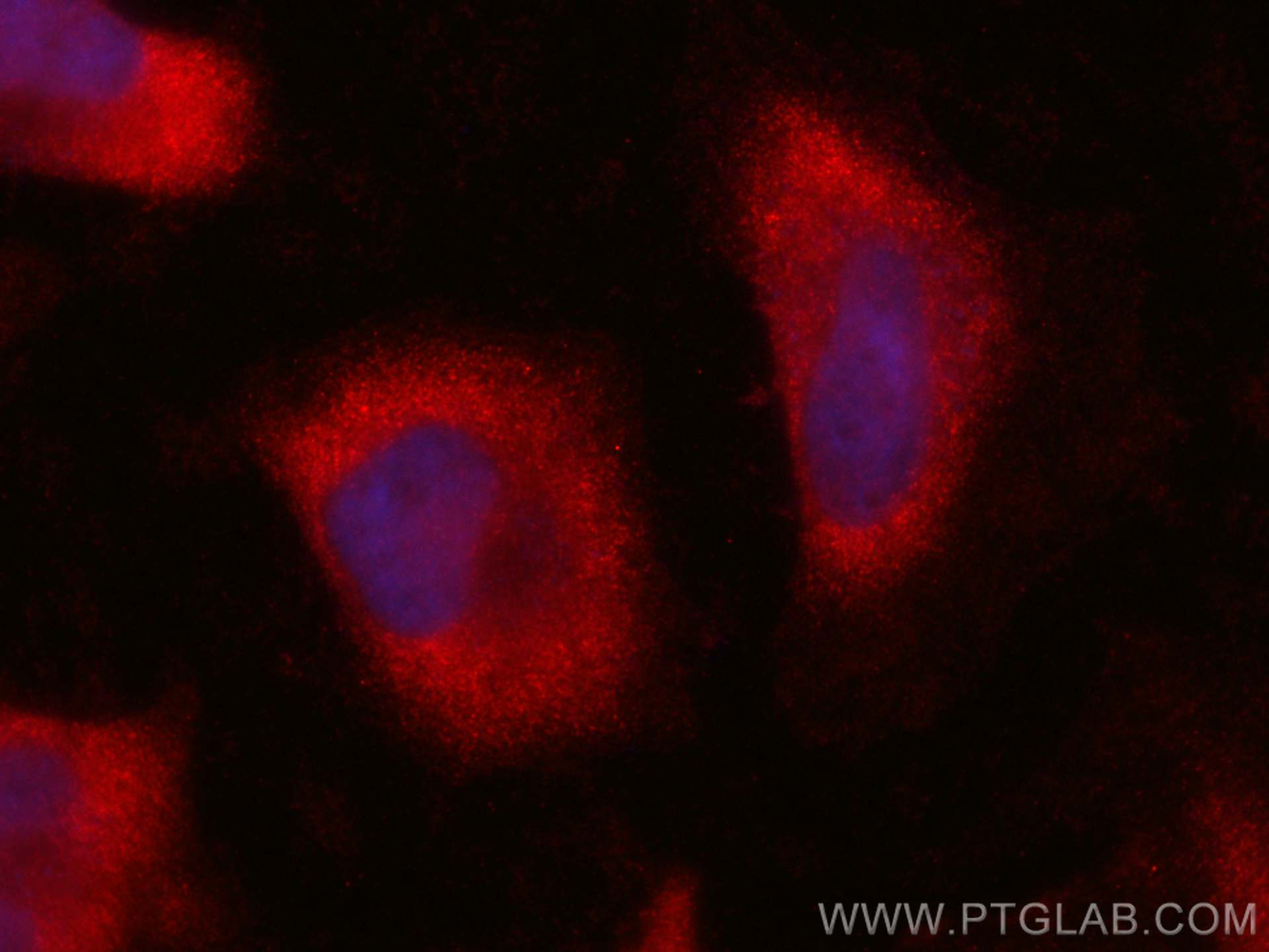 Immunofluorescence (IF) / fluorescent staining of HeLa cells using CoraLite®594-conjugated SGTA Monoclonal antibody (CL594-60305)