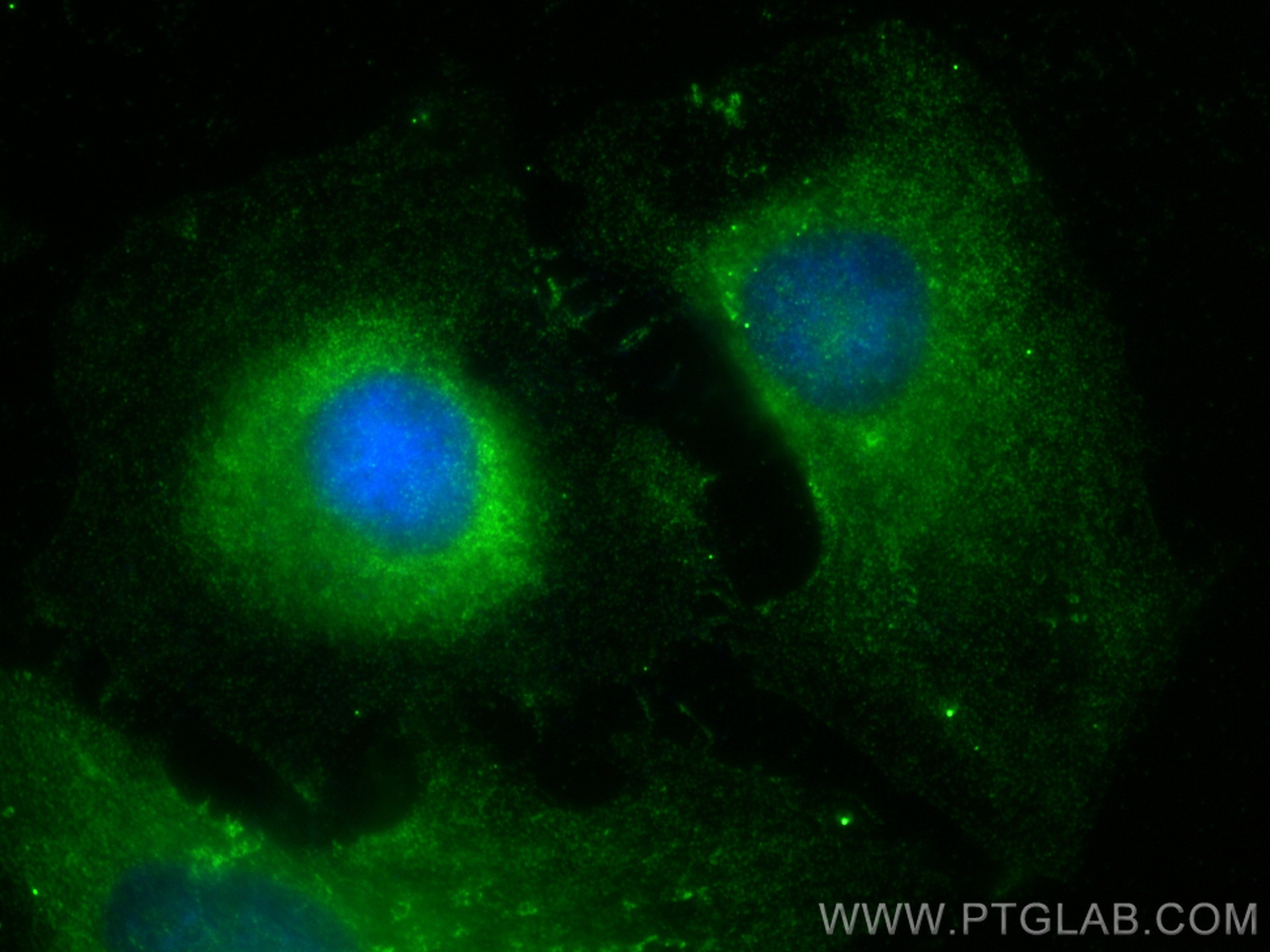 Immunofluorescence (IF) / fluorescent staining of HeLa cells using SH2D4A Polyclonal antibody (15957-1-AP)