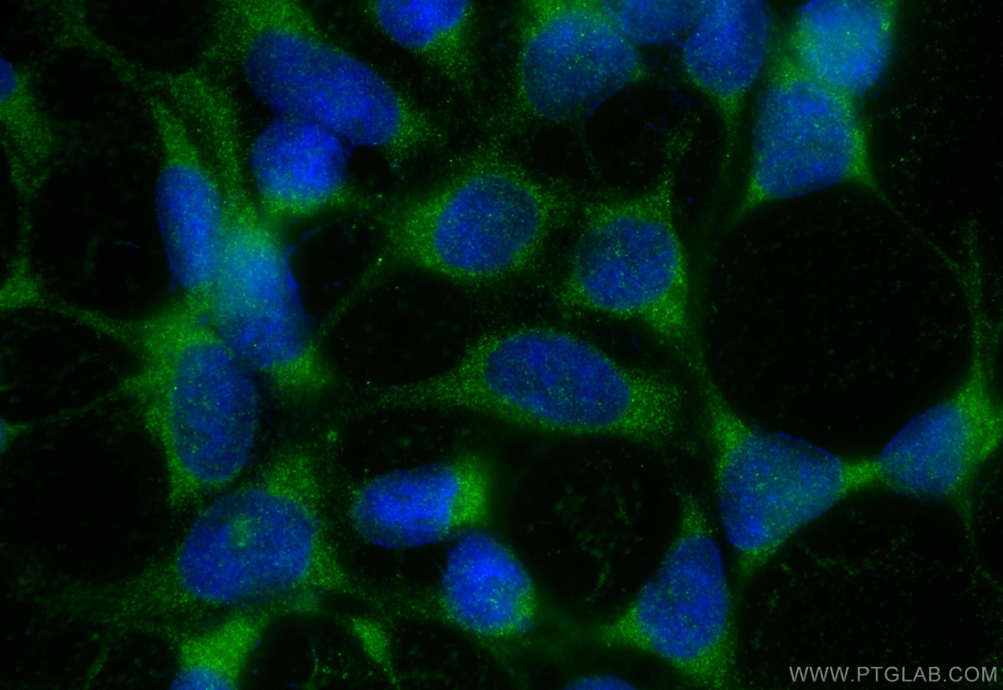 Immunofluorescence (IF) / fluorescent staining of HEK-293 cells using SH2D5 Polyclonal antibody (55320-1-AP)