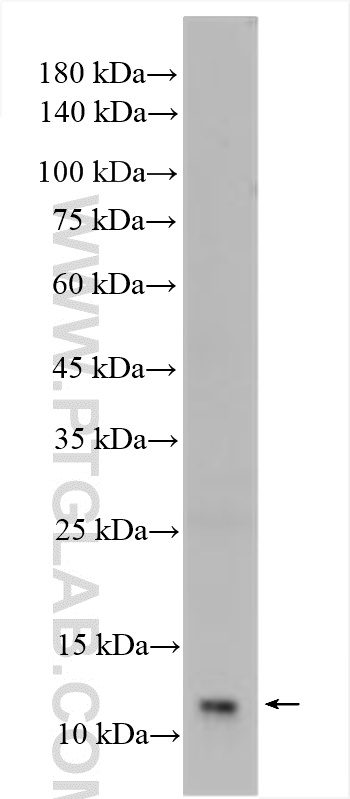 Western Blot (WB) analysis of mouse colon tissue using SH3BGRL Polyclonal antibody (11253-1-AP)