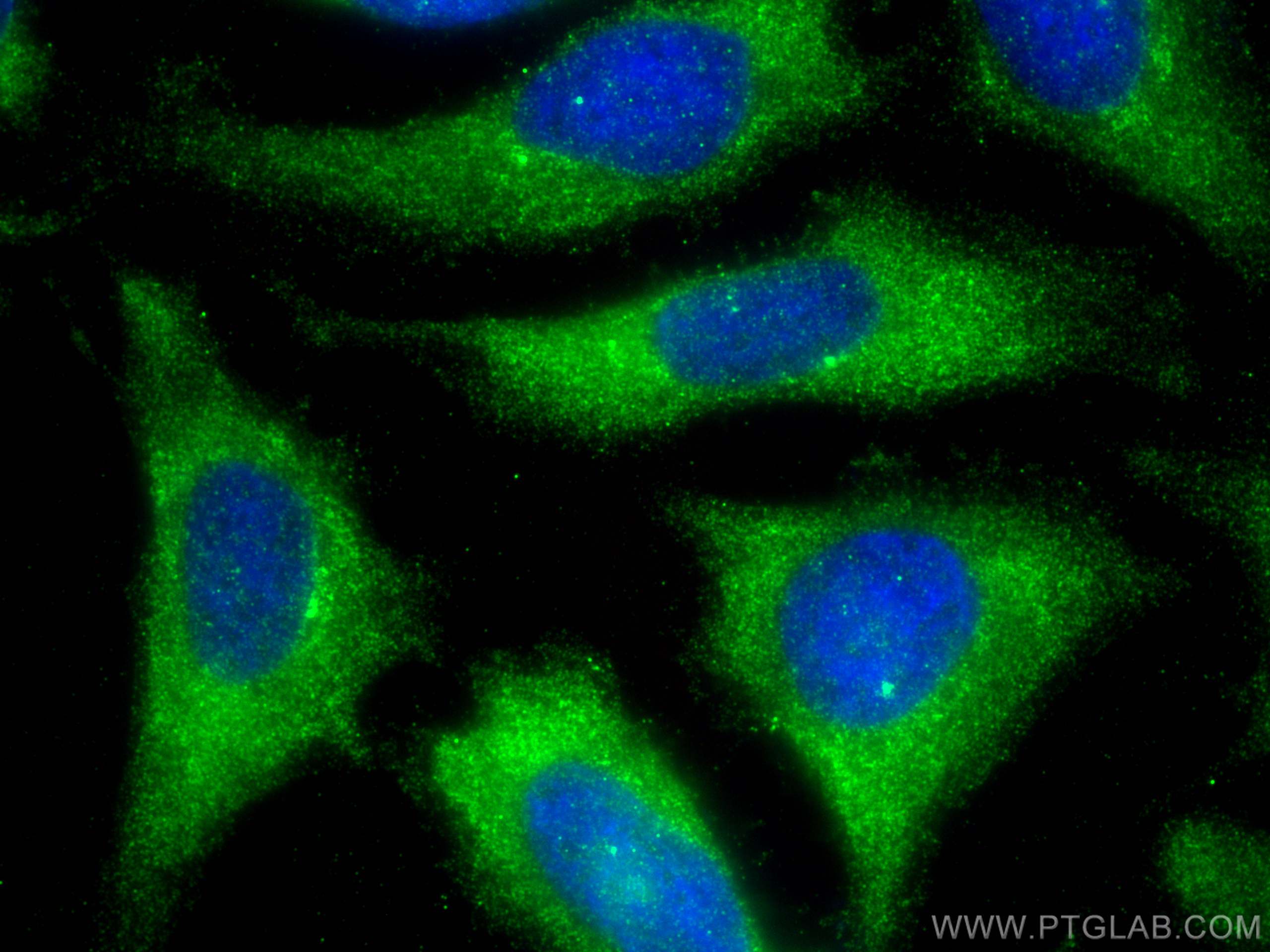 Immunofluorescence (IF) / fluorescent staining of HeLa cells using SH3BP1 Polyclonal antibody (20541-1-AP)