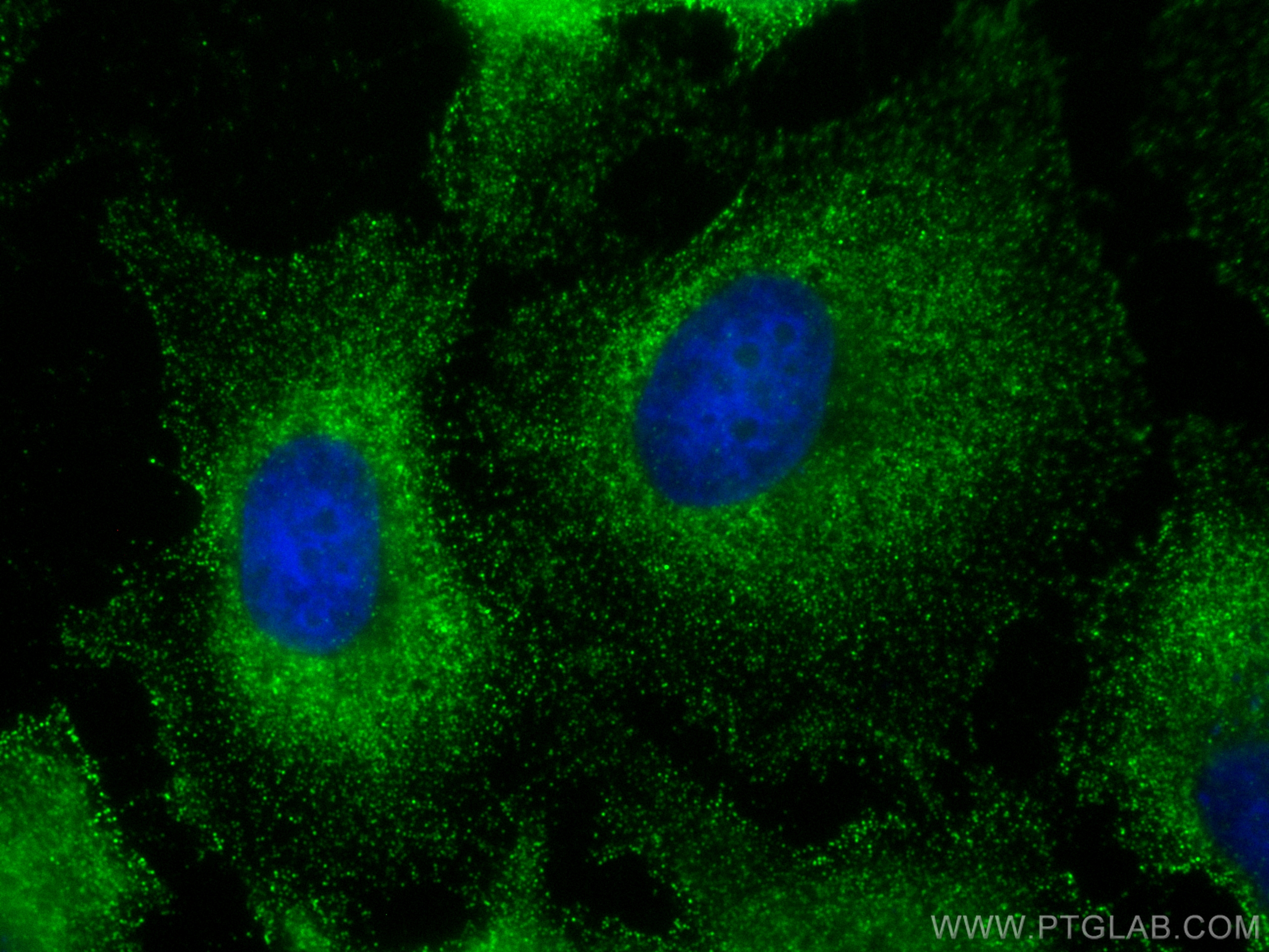 Immunofluorescence (IF) / fluorescent staining of HeLa cells using SH3BP1 Monoclonal antibody (68328-1-Ig)