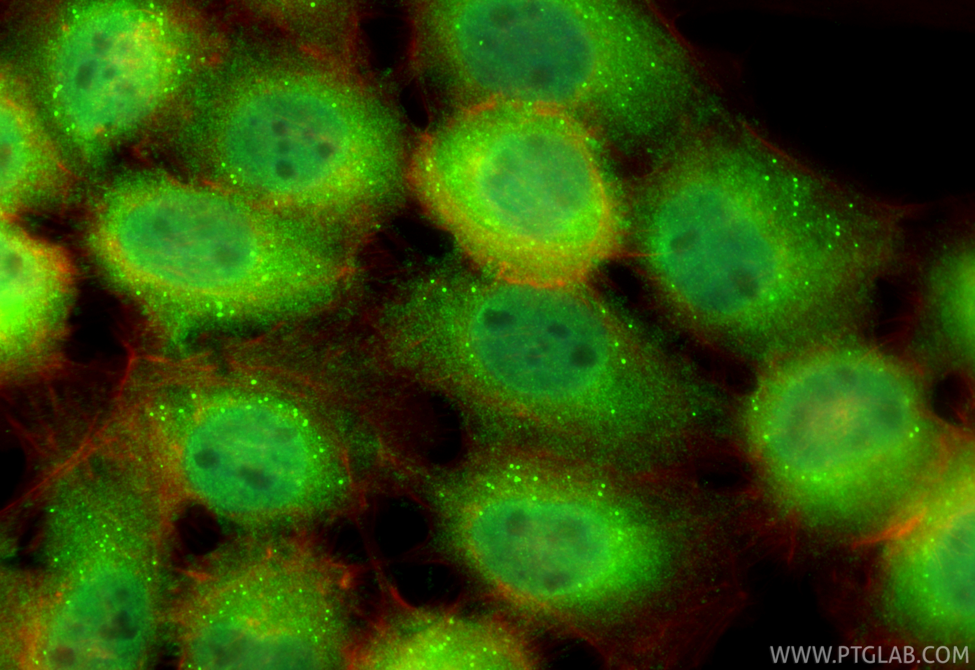 Immunofluorescence (IF) / fluorescent staining of A431 cells using SH3D19 Polyclonal antibody (21499-1-AP)