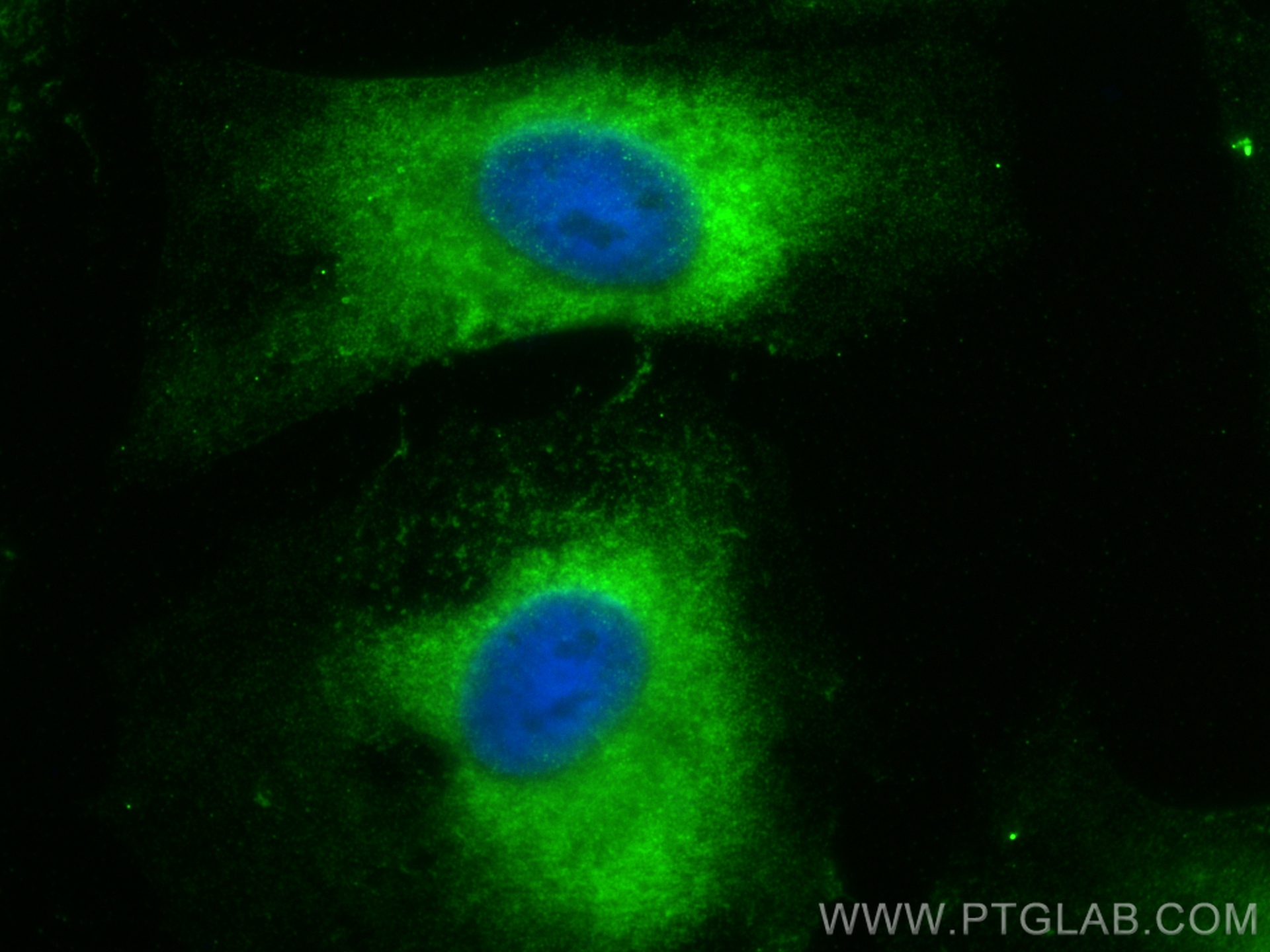 Immunofluorescence (IF) / fluorescent staining of HeLa cells using SH3GLB2 Polyclonal antibody (15897-1-AP)