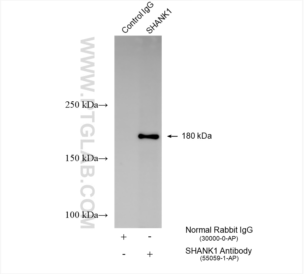 Immunoprecipitation (IP) experiment of HEK-293T cells using SHANK1 Polyclonal antibody (55059-1-AP)