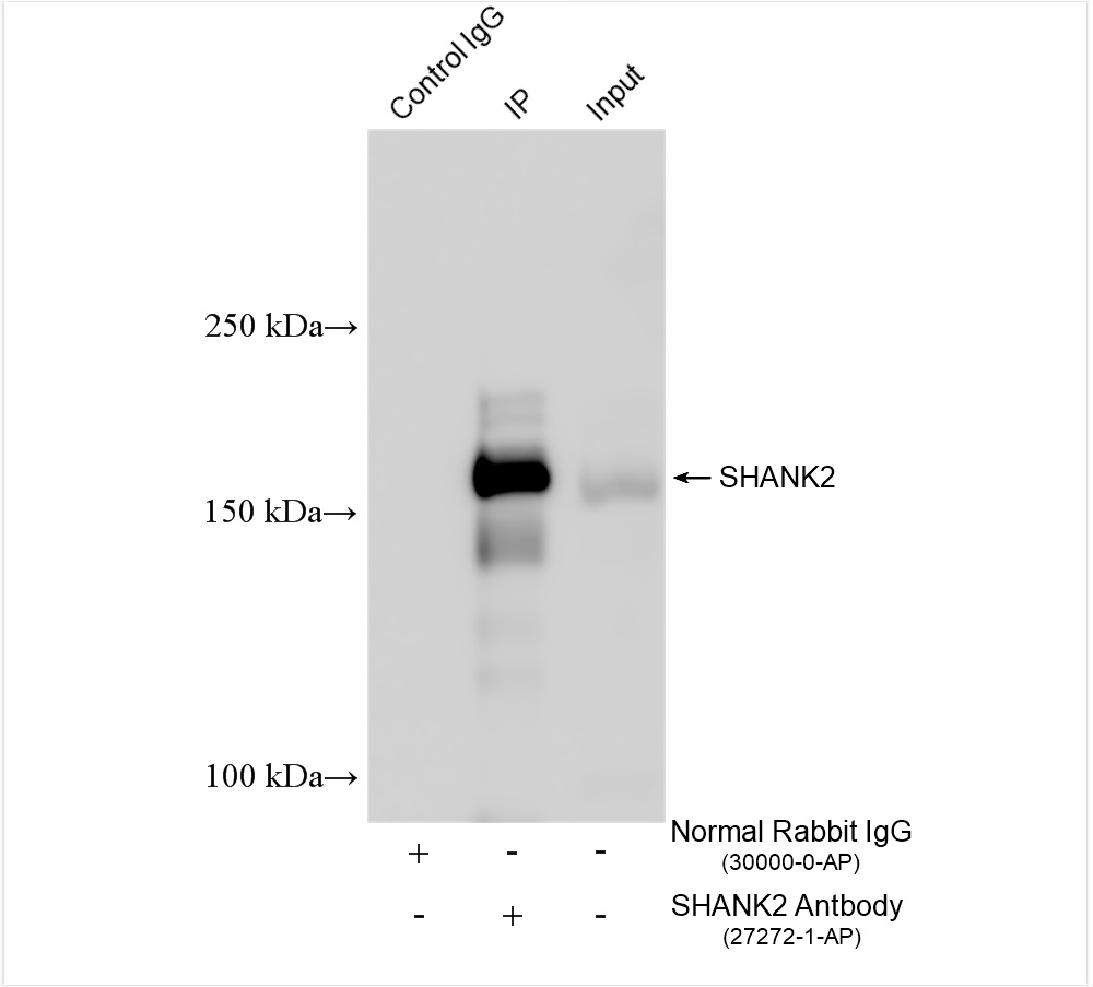 Immunoprecipitation (IP) experiment of mouse brain tissue using SHANK2 Polyclonal antibody (27272-1-AP)