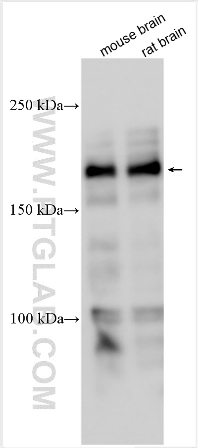 Western Blot (WB) analysis of various lysates using SHANK2 Polyclonal antibody (27272-1-AP)