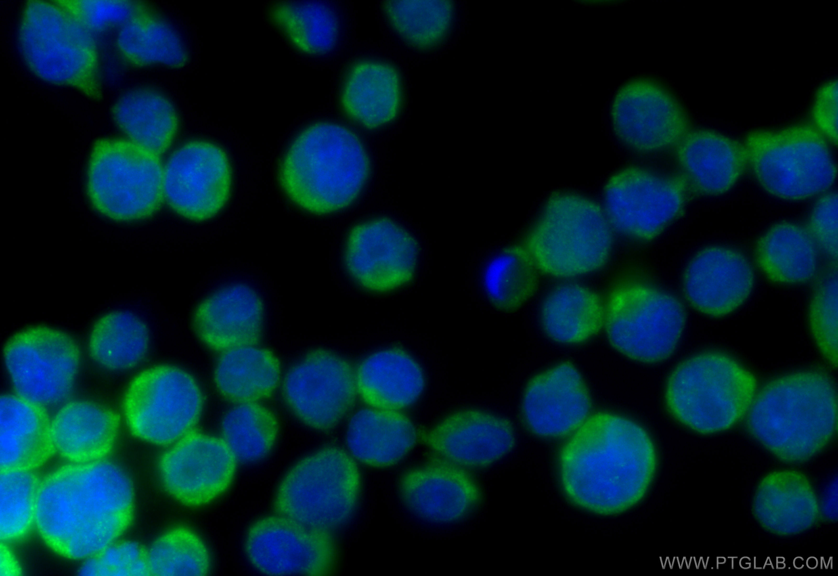 Immunofluorescence (IF) / fluorescent staining of Jurkat cells using SHARPIN Polyclonal antibody (14626-1-AP)