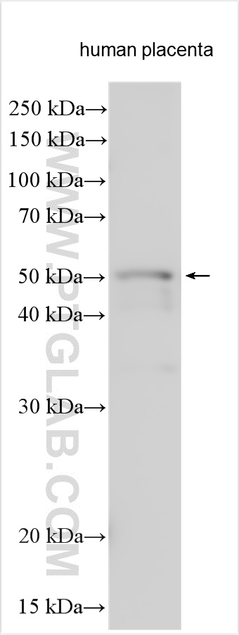 Western Blot (WB) analysis of human placenta tissue using SHBG Polyclonal antibody (31025-1-AP)