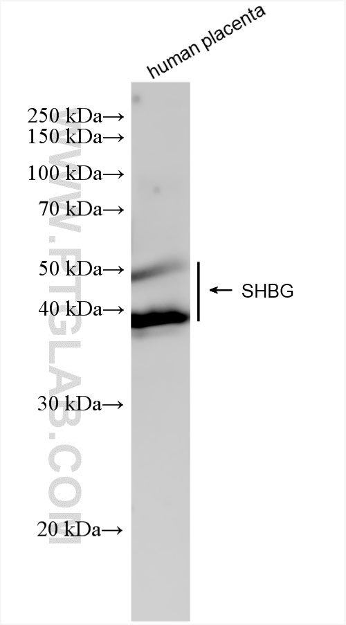 Western Blot (WB) analysis of human placenta tissue using SHBG Recombinant antibody (83096-1-RR)