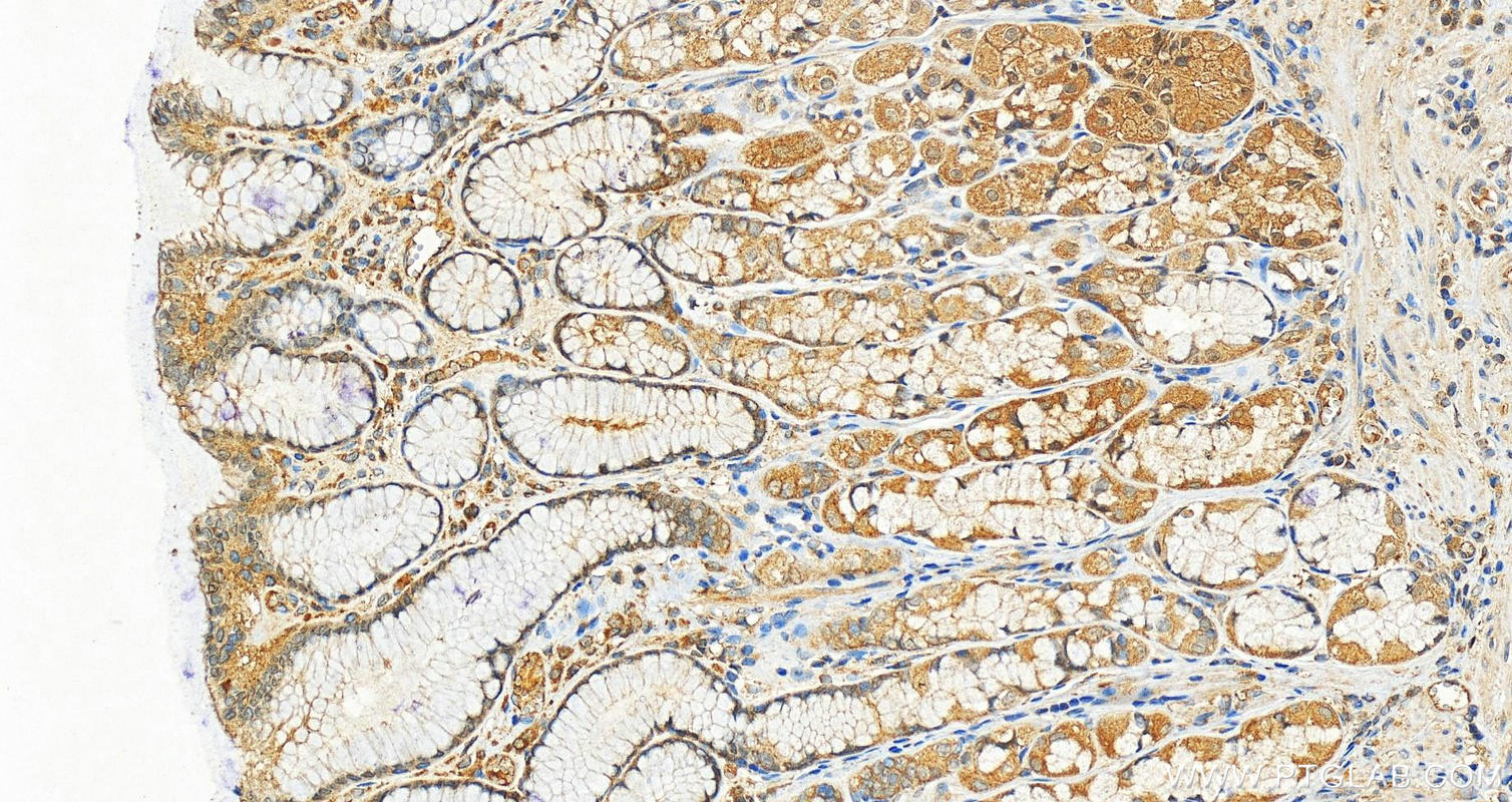 Immunohistochemistry (IHC) staining of human stomach tissue using SHC1 Polyclonal antibody (12496-1-AP)