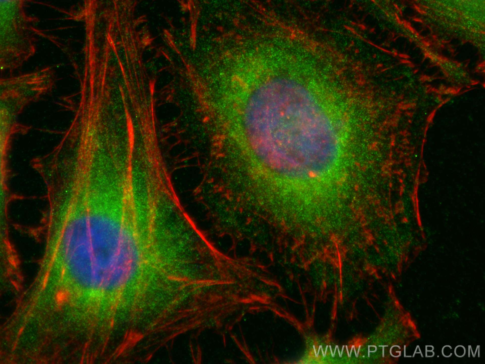 Immunofluorescence (IF) / fluorescent staining of HeLa cells using SHC Polyclonal antibody (12496-1-AP)