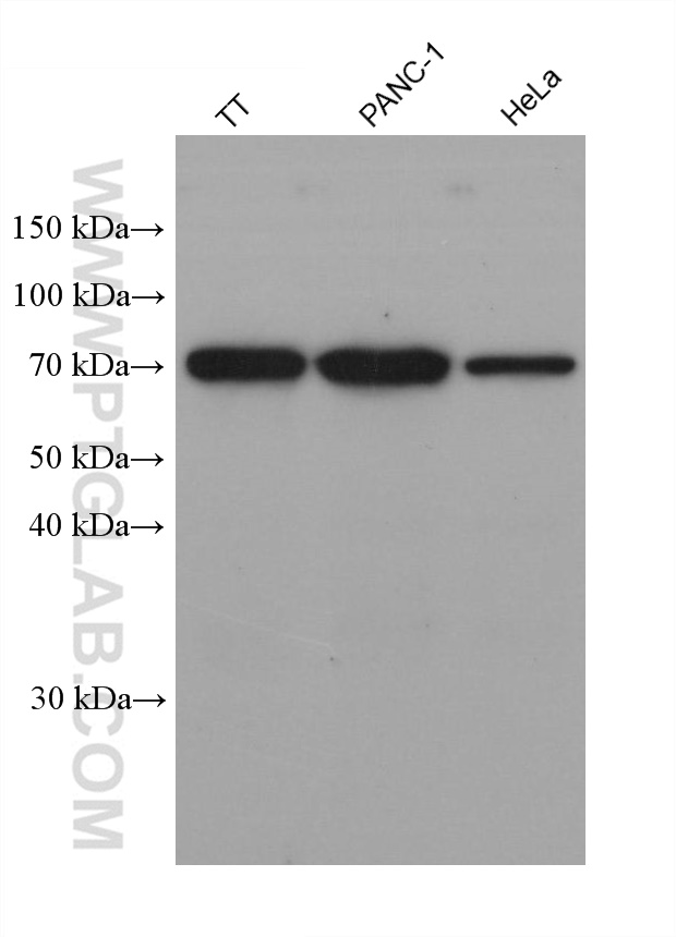 Western Blot (WB) analysis of various lysates using SHC1 Monoclonal antibody (67194-2-Ig)