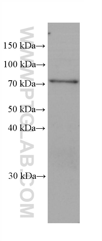 Western Blot (WB) analysis of hTERT-RPE1 cells using SHC1 Monoclonal antibody (67194-2-Ig)