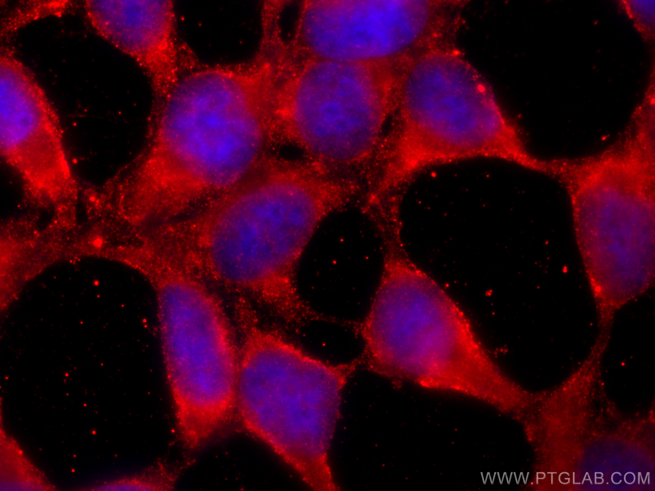 Immunofluorescence (IF) / fluorescent staining of HEK-293 cells using SHCBP1 Monoclonal antibody (68647-1-Ig)