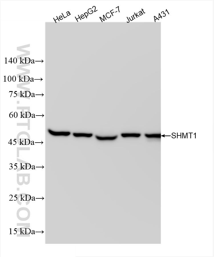 Western Blot (WB) analysis of various lysates using SHMT1 Recombinant antibody (85758-5-RR)