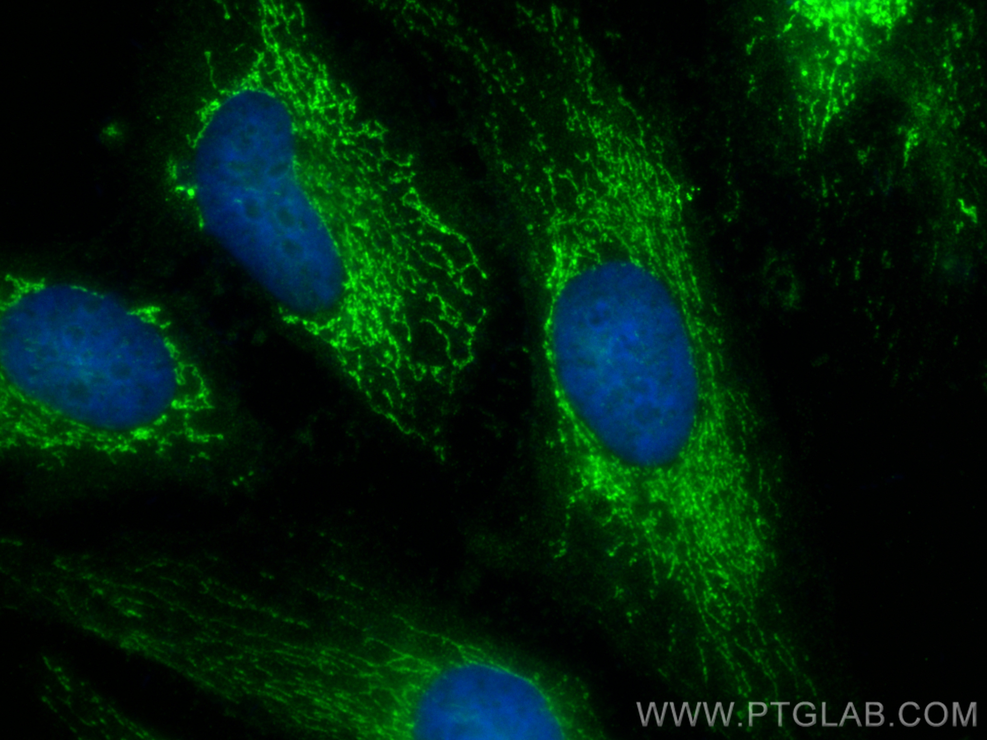 Immunofluorescence (IF) / fluorescent staining of HeLa cells using SHMT2 Polyclonal antibody (11099-1-AP)