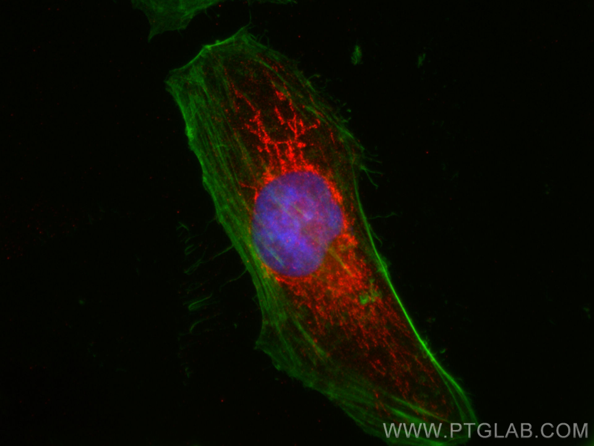 Immunofluorescence (IF) / fluorescent staining of HeLa cells using SHMT2 Polyclonal antibody (11099-1-AP)