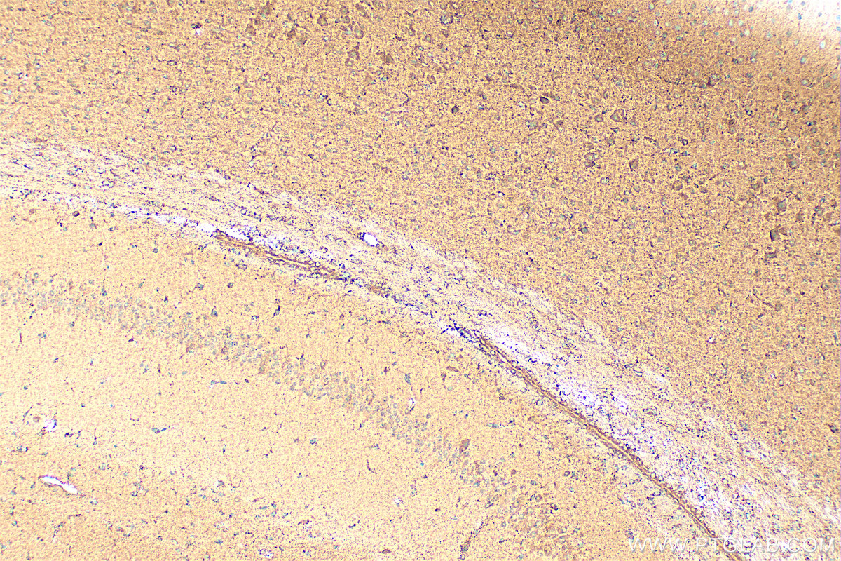 Immunohistochemistry (IHC) staining of mouse brain tissue using SHMT2 Polyclonal antibody (11099-1-AP)