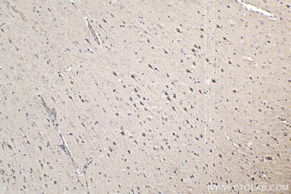 Immunohistochemistry (IHC) staining of rat brain tissue using SHOX2 Polyclonal antibody (16366-1-AP)