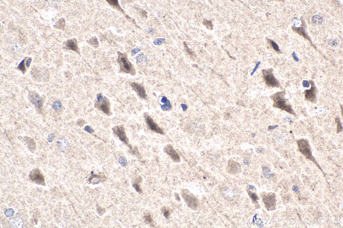 Immunohistochemistry (IHC) staining of rat brain tissue using SHOX2 Polyclonal antibody (16366-1-AP)