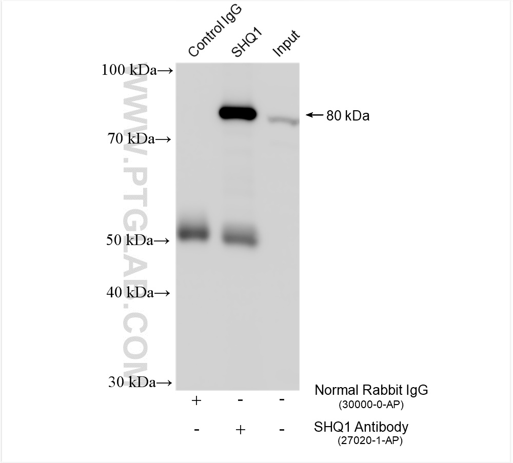 Immunoprecipitation (IP) experiment of K-562 cells using SHQ1 Polyclonal antibody (27020-1-AP)