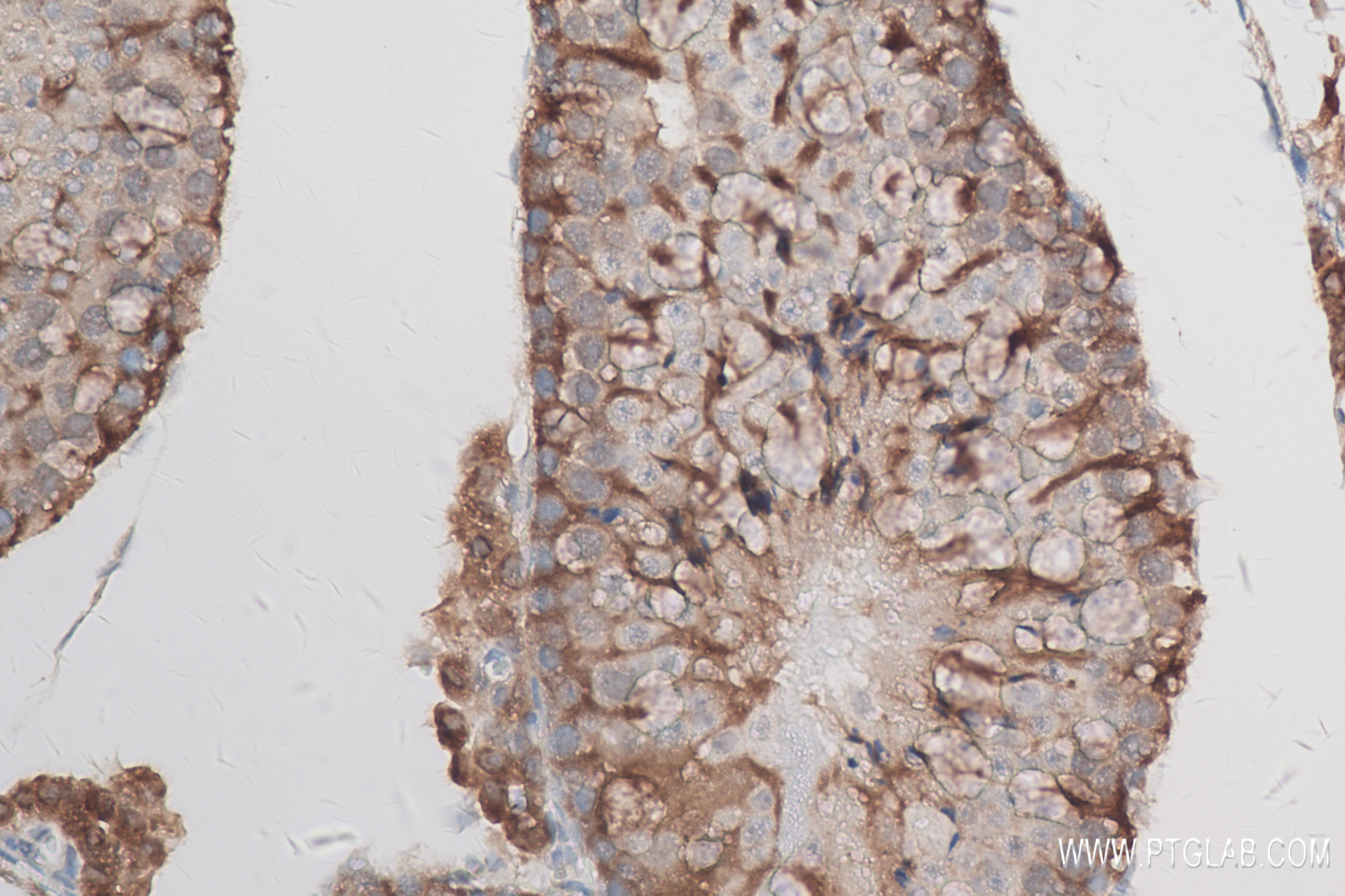 Immunohistochemistry (IHC) staining of mouse testis tissue using SIAH1 Recombinant antibody (83389-4-RR)