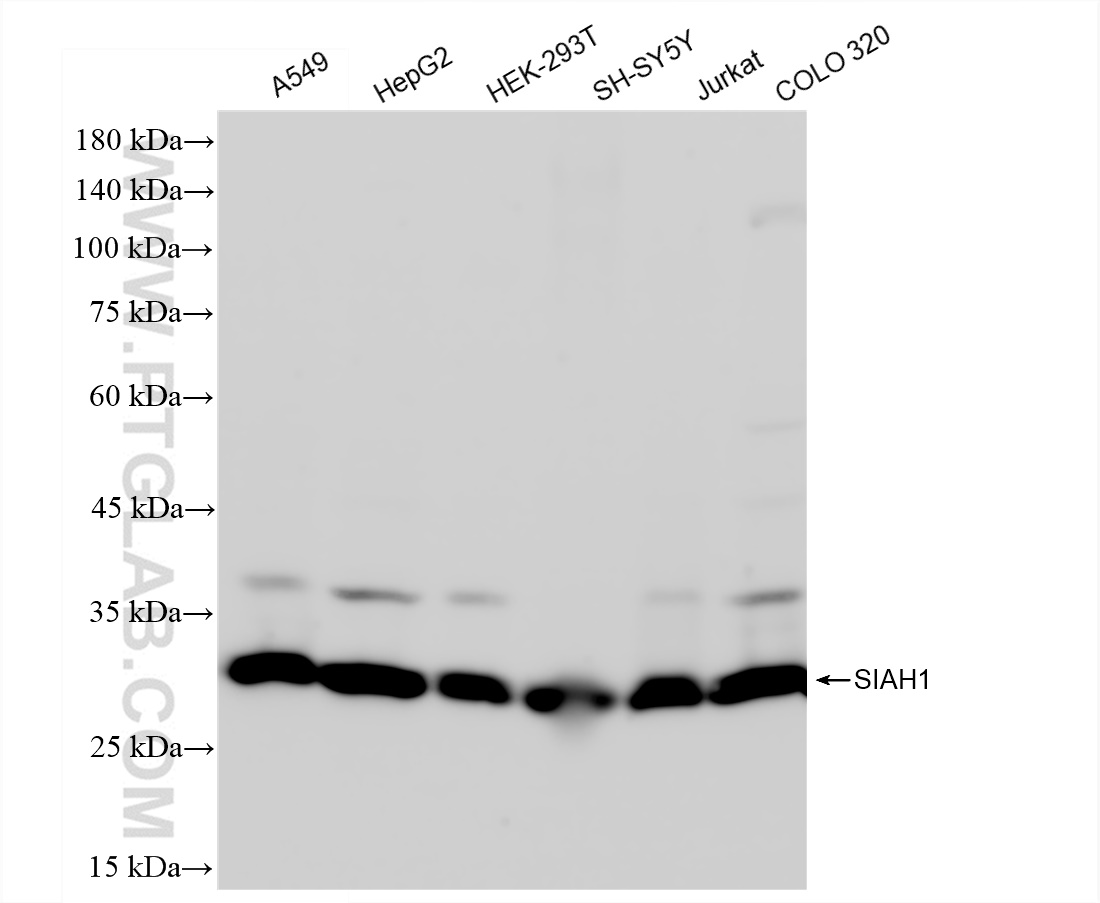 Western Blot (WB) analysis of various lysates using SIAH1 Recombinant antibody (83389-4-RR)