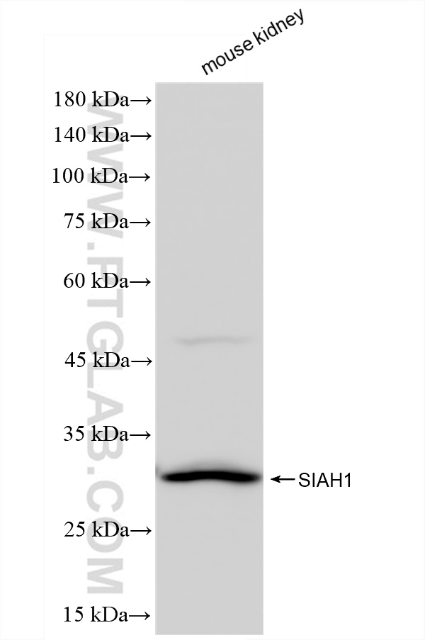 Western Blot (WB) analysis of mouse kidney tissue using SIAH1 Recombinant antibody (83389-4-RR)