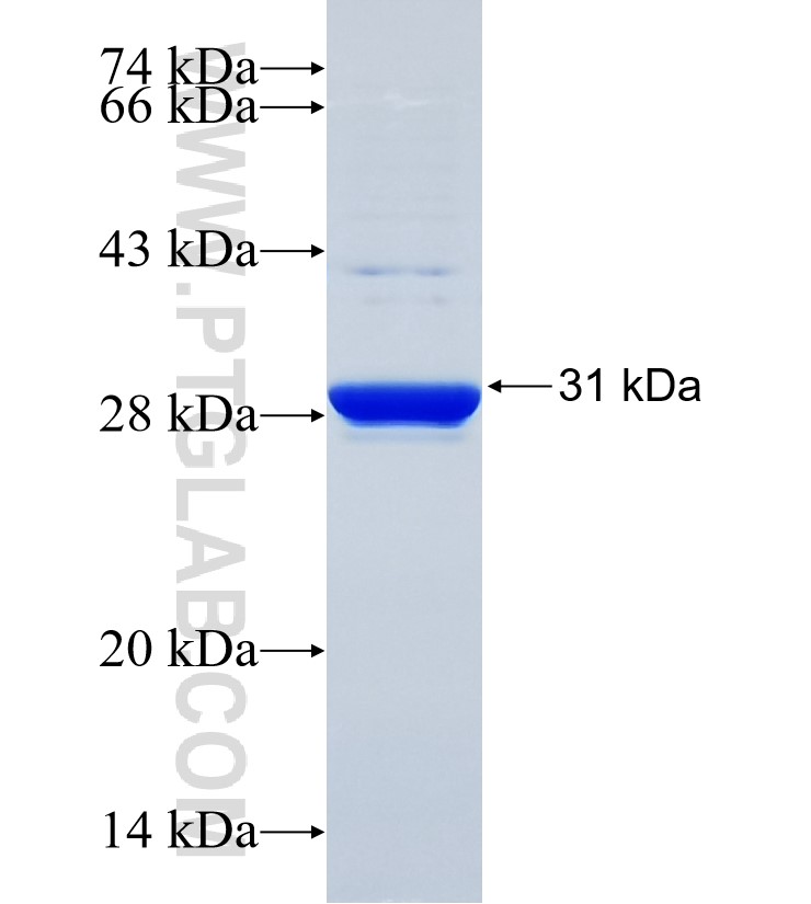 SIAH1 fusion protein Ag34618 SDS-PAGE